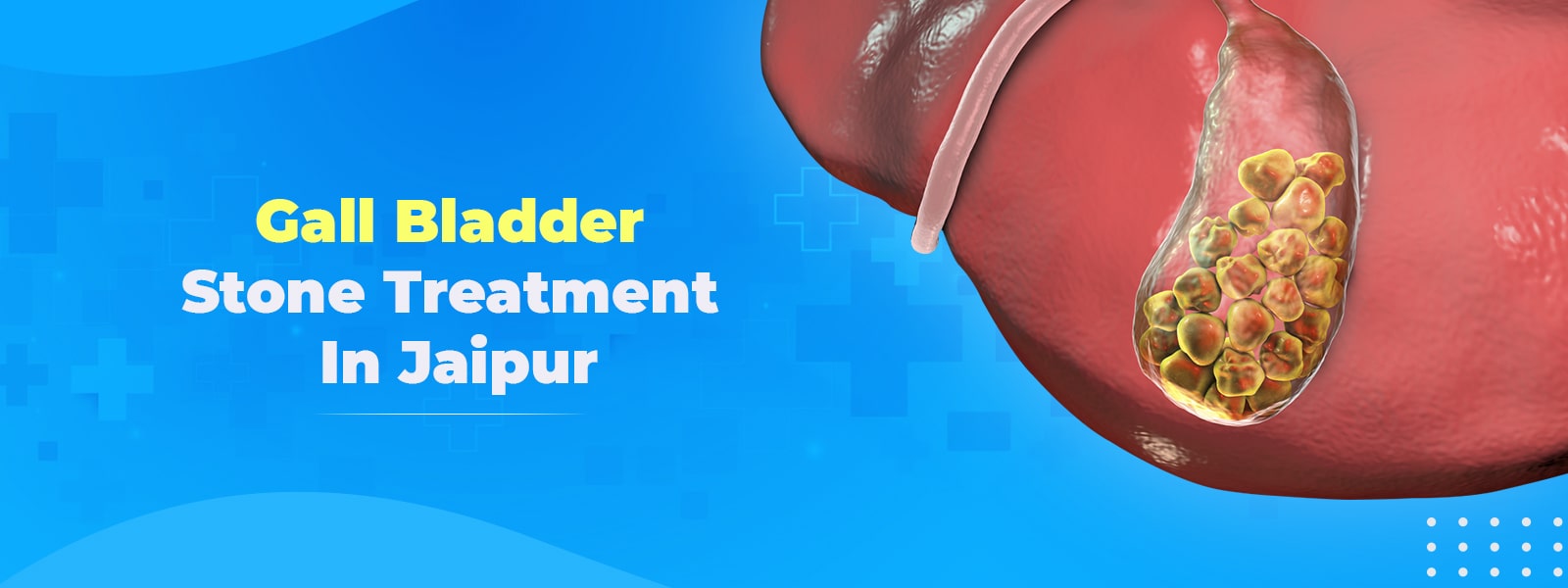 Gall Bladder Stone Treatment in Jaipur